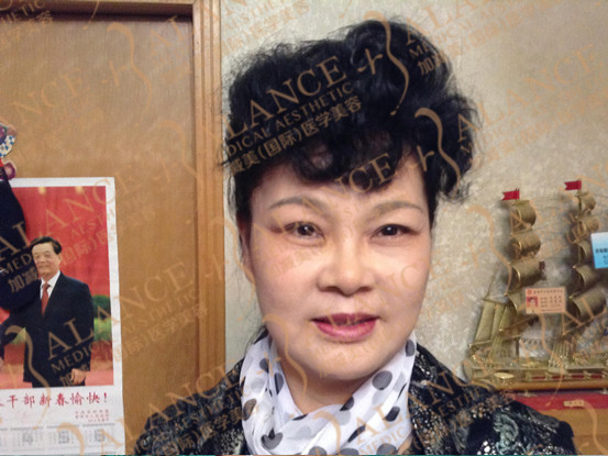 V美减龄案例